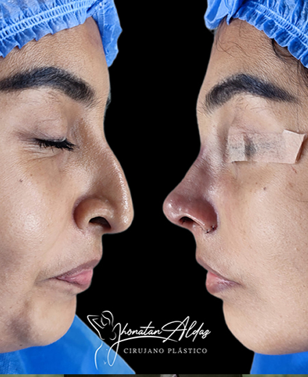 client-img