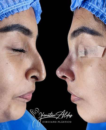 client-img