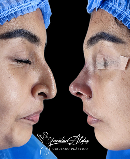 client-img